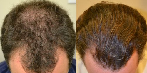 Before and after using Ora K