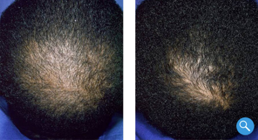 Before and after using Ora K