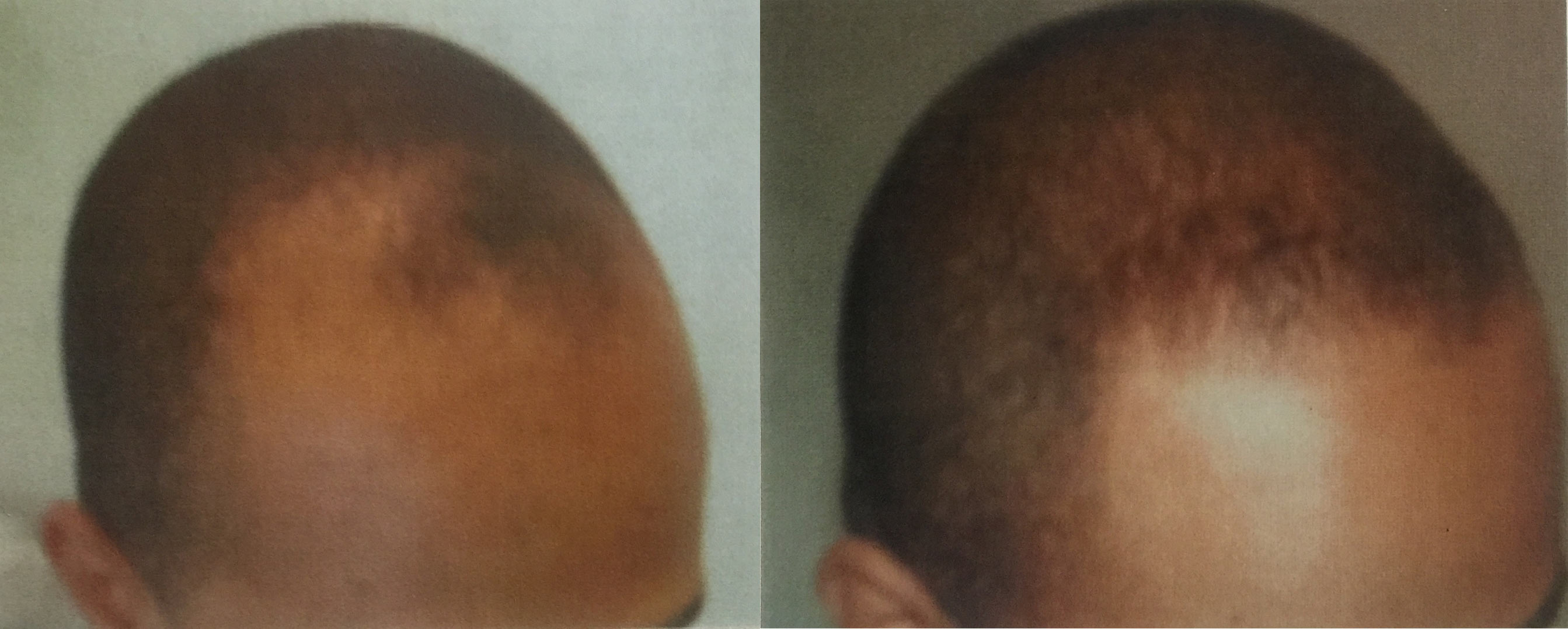 Before and after using Ora K