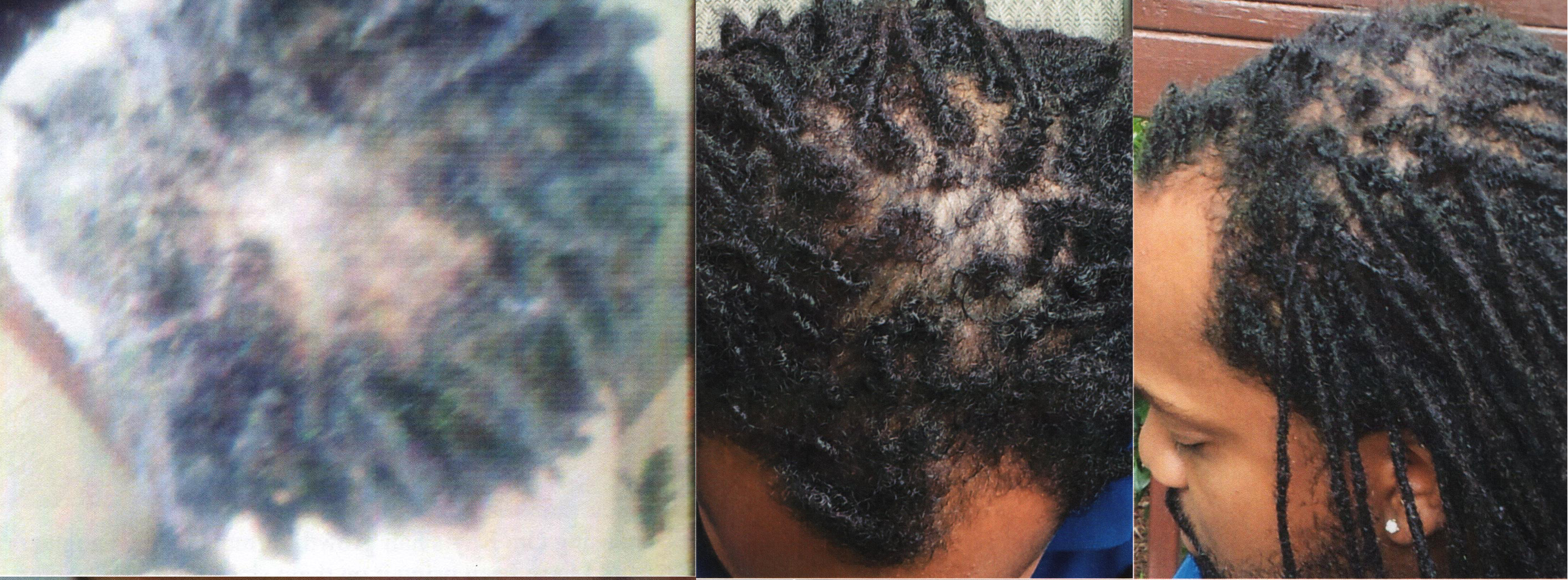 Before and after using Ora K