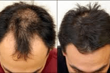 Before and after using Ora K