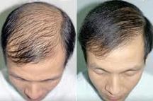 Before and after using Ora K