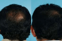 Before and after using Ora K