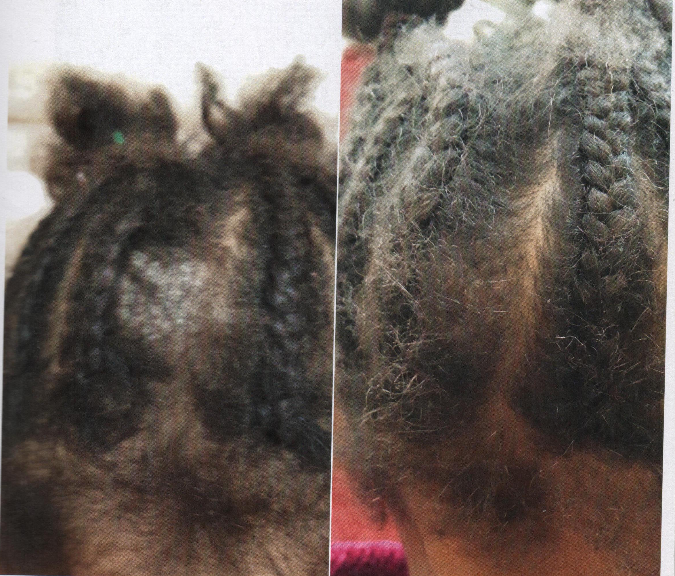 Before and after using Ora K